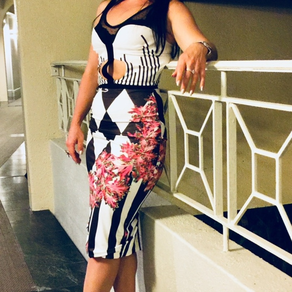 Chic Black and White Backless Dress with Floral Design